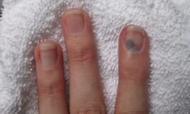 Finger!
