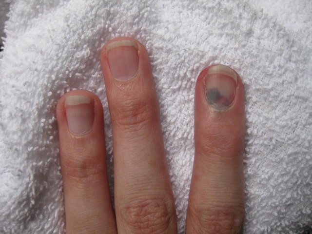 Read more about the article Finger!